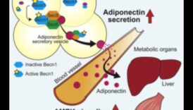 Πρωτεΐνη Το σημαντικό πράγμα για την ευαισθησία ανατρέχοντας ινσουλίνη 6 Η επίδραση της πρωτεΐνης στην ευαισθησία στην ινσουλίνη: Μια ολιστική προσέγγιση