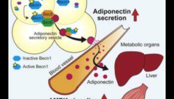 Η επίδραση της πρωτεΐνης στην ευαισθησία στην ινσουλίνη: Μια ολιστική προσέγγιση